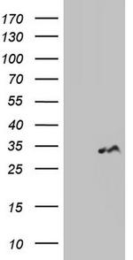 LGALS3 Antibody in Western Blot (WB)