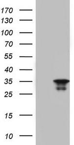 LGALS3 Antibody in Western Blot (WB)