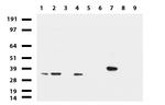 LGALS3 Antibody in Western Blot (WB)