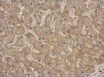 LGALS3BP Antibody in Immunohistochemistry (IHC)