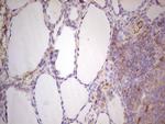 LGALS9 Antibody in Immunohistochemistry (Paraffin) (IHC (P))