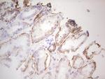 LGALS9 Antibody in Immunohistochemistry (Paraffin) (IHC (P))