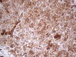 LGALS9 Antibody in Immunohistochemistry (Paraffin) (IHC (P))
