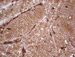 LGALS9 Antibody in Immunohistochemistry (Paraffin) (IHC (P))