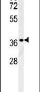 LGALS9B Antibody in Western Blot (WB)
