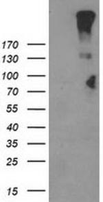 LGR5 Antibody in Western Blot (WB)