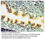 Luteinizing Hormone Polyclonal Antibody