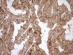 LIMA1 Antibody in Immunohistochemistry (Paraffin) (IHC (P))