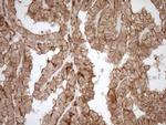 LIMA1 Antibody in Immunohistochemistry (Paraffin) (IHC (P))