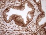 LIMA1 Antibody in Immunohistochemistry (Paraffin) (IHC (P))