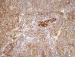 LIMA1 Antibody in Immunohistochemistry (Paraffin) (IHC (P))