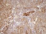 LIMA1 Antibody in Immunohistochemistry (Paraffin) (IHC (P))