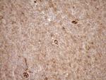 LIMA1 Antibody in Immunohistochemistry (Paraffin) (IHC (P))