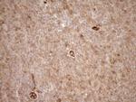 LIMA1 Antibody in Immunohistochemistry (Paraffin) (IHC (P))