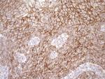 LIMA1 Antibody in Immunohistochemistry (Paraffin) (IHC (P))