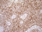 LIMA1 Antibody in Immunohistochemistry (Paraffin) (IHC (P))