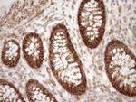 LIMA1 Antibody in Immunohistochemistry (Paraffin) (IHC (P))