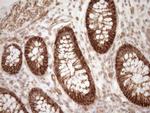 LIMA1 Antibody in Immunohistochemistry (Paraffin) (IHC (P))