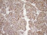 LIMA1 Antibody in Immunohistochemistry (Paraffin) (IHC (P))