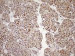 LIMA1 Antibody in Immunohistochemistry (Paraffin) (IHC (P))