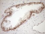 LIMA1 Antibody in Immunohistochemistry (Paraffin) (IHC (P))