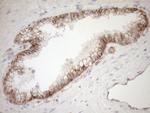 LIMA1 Antibody in Immunohistochemistry (Paraffin) (IHC (P))
