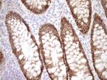 LIMA1 Antibody in Immunohistochemistry (Paraffin) (IHC (P))
