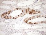 LIMA1 Antibody in Immunohistochemistry (Paraffin) (IHC (P))