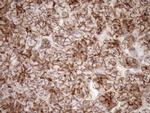 LIMA1 Antibody in Immunohistochemistry (Paraffin) (IHC (P))