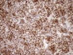 LIMA1 Antibody in Immunohistochemistry (Paraffin) (IHC (P))