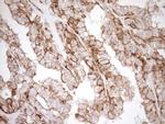 LIMA1 Antibody in Immunohistochemistry (Paraffin) (IHC (P))