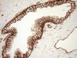 LIMA1 Antibody in Immunohistochemistry (Paraffin) (IHC (P))