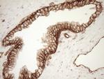 LIMA1 Antibody in Immunohistochemistry (Paraffin) (IHC (P))