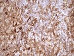 LIMA1 Antibody in Immunohistochemistry (Paraffin) (IHC (P))