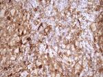 LIMA1 Antibody in Immunohistochemistry (Paraffin) (IHC (P))
