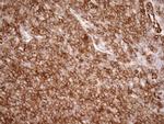 LIMA1 Antibody in Immunohistochemistry (Paraffin) (IHC (P))