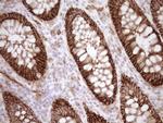 LIMA1 Antibody in Immunohistochemistry (Paraffin) (IHC (P))
