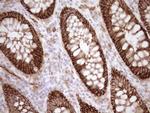 LIMA1 Antibody in Immunohistochemistry (Paraffin) (IHC (P))