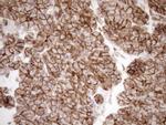LIMA1 Antibody in Immunohistochemistry (Paraffin) (IHC (P))