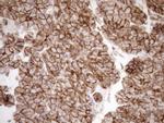 LIMA1 Antibody in Immunohistochemistry (Paraffin) (IHC (P))