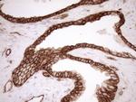 LIMA1 Antibody in Immunohistochemistry (Paraffin) (IHC (P))