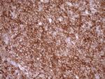 LIMA1 Antibody in Immunohistochemistry (Paraffin) (IHC (P))