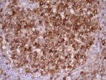 LIMA1 Antibody in Immunohistochemistry (Paraffin) (IHC (P))