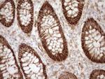 LIMA1 Antibody in Immunohistochemistry (Paraffin) (IHC (P))