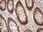LIMA1 Antibody in Immunohistochemistry (Paraffin) (IHC (P))