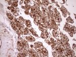 LIMA1 Antibody in Immunohistochemistry (Paraffin) (IHC (P))