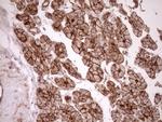 LIMA1 Antibody in Immunohistochemistry (Paraffin) (IHC (P))