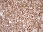LIMA1 Antibody in Immunohistochemistry (Paraffin) (IHC (P))