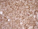 LIMA1 Antibody in Immunohistochemistry (Paraffin) (IHC (P))