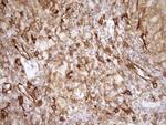 LIMA1 Antibody in Immunohistochemistry (Paraffin) (IHC (P))